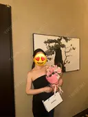 脂肪吸引（二の腕） / 脂肪吸引（背中） オアシス美容外科 DAY 120 サムネイル用
