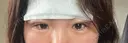 二重埋没 / ヒアルロン酸注入（涙袋） / ハイフ（顔） TCB東京中央美容外科 札幌駅前院 DAY 1 サムネイル用