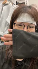 二重埋没 / ヒアルロン酸注入（涙袋） / ハイフ（顔） TCB東京中央美容外科 札幌駅前院 DAY 2 サムネイル用