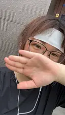 二重埋没 / ヒアルロン酸注入（涙袋） / ハイフ（顔） TCB東京中央美容外科 札幌駅前院 DAY 3 サムネイル用