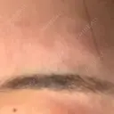 アートメイク（眉） 表参道メディカルクリニック 新宿院 AFTER サムネイル用