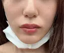 ショッピングリフト BAO CLINIC 梅田院 DAY 0 サムネイル用