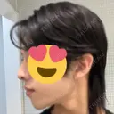 ヒアルロン酸注入（あご） TCB東京中央美容外科 新潟院 DAY 0 サムネイル用