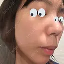 水光注射（ハリ・美肌） / マイクロボトックス DAILY SKIN CLINIC 心斎橋院 DAY 4 サムネイル用