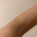 ボトックス（肩） / 高濃度ビタミンC点滴 小倉美容外科/美容皮膚科 ビラビューティークリニック DAY 8 サムネイル用