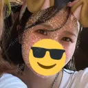 二重埋没 アリエル美容クリニック 郡山院 DAY 49 サムネイル用