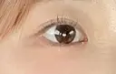 二重切開 Olino美容外科・美容皮膚科 AFTER サムネイル用