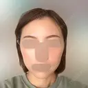 脂肪吸引（顔） / ボトックス（エラ・小顔） Mods Clinic（モッズクリニック） 東京院 DAY 58 サムネイル用