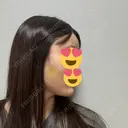 脂肪吸引（顔） / 脂肪吸引（脚） / 脂肪注入（肌） / 脂肪注入（額） / 脂肪注入（目の下） / 脂肪注入（輪郭） ヴェルトラクリニック 新宿院 DAY 6 サムネイル用