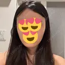 脂肪吸引（顔） / 脂肪吸引（脚） / 脂肪注入（肌） / 脂肪注入（額） / 脂肪注入（目の下） / 脂肪注入（輪郭） ヴェルトラクリニック 新宿院 AFTER サムネイル用