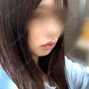 ヒアルロン酸注入（唇） / ボトックス（口角） ルラ美容クリニック 大阪本院 DAY 0 サムネイル用