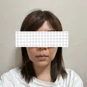 バッカルファット除去 アリエル美容クリニック 大宮院 DAY 28 サムネイル用