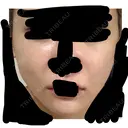 糸リフト / ボトックス（あご） / ボトックス（口角） / ボトックス（タレ目） / ボトックス（肩） / ボトックス（目尻） 東京シルククリニック 新宿院 AFTER サムネイル用