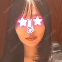 ヒアルロン酸注入（あご） / ヒアルロン酸注入（頬） / ヒアルロン酸注入（こめかみ） / ヒアルロン酸注入（鼻翼基部） DMTC CLINIC 日本橋院 AFTER サムネイル用