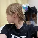 二重埋没 / 目頭切開 / 糸リフト / 脂肪吸引（顔） / ジョールファット除去 / ヒアルロン酸注入（あご） Wing clinic 豊中駅前院 DAY 89 サムネイル用