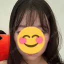 RF（高周波）たるみ治療 BITO BEAUTY CLINIC DAY 11 サムネイル用