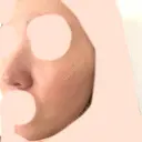 ピーリング（ハリ・ツヤ） 大美会クリニック 梅田院 AFTER サムネイル用