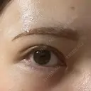 アートメイク（眉） Kinshicho Beauty Clinic （錦糸町ビューティークリニック） DAY 1 サムネイル用