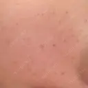 ルメッカ ON-CLINIC Beauty AFTER サムネイル用