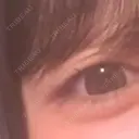 ヒアルロン酸注入（涙袋） TCB東京中央美容外科 長野院 AFTER サムネイル用