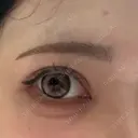 アートメイク（眉） Kinshicho Beauty Clinic （錦糸町ビューティークリニック） DAY 3 サムネイル用