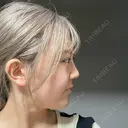 クマ治療 / リジュラン エートップ美容整形外科 DAY 27 サムネイル用