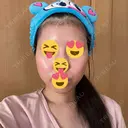 糸リフト / 脂肪吸引（顔） / ヒアルロン酸注入（あご） Wing clinic 豊中駅前院 DAY 6 サムネイル用