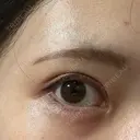 アートメイク（眉） Kinshicho Beauty Clinic （錦糸町ビューティークリニック） AFTER サムネイル用