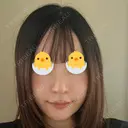 隆鼻術 / 鼻尖形成（切開） / 小鼻縮小（切開） / 軟骨移植 / 鼻修正 / 鼻尖縮小 WOM CLINIC GINZA （ワム クリニック ギンザ） AFTER サムネイル用