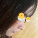 隆鼻術 / 鼻尖形成（切開） / 小鼻縮小（切開） / 軟骨移植 / 鼻修正 / 鼻尖縮小 WOM CLINIC GINZA （ワム クリニック ギンザ） DAY 63 サムネイル用