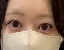 目頭切開 Brandnew Beauty Clinic DAY 293 サムネイル用