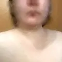 ボトックス（肩） アリエル美容クリニック 横浜院 DAY 7 サムネイル用