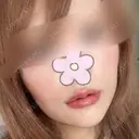 ヒアルロン酸注入（唇） 目白ホワイトクリニック DAY 1 サムネイル用