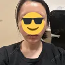 その他（輪郭） / 医療痩身（顔） / その他（肌） / RF（高周波）たるみ治療 ライブリークリニック 浜松町院 AFTER サムネイル用
