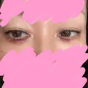 ヒアルロン酸注入（涙袋） AZ BEAUTY CLINIC DAY 0 サムネイル用