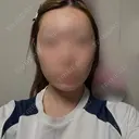 脂肪吸引（顔） / ジョールファット除去 アリエル美容クリニック 横浜院 DAY 55 サムネイル用