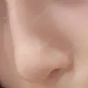 鼻尖形成（切開） / 軟骨移植 / ボトックス（あご） 北尾クリニック DAY 157 サムネイル用