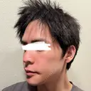 骨切り（あご） / 骨削り（頬） / 輪郭修正 シェリークリニック 渋谷院 DAY 29 サムネイル用