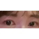 目頭切開 ネビュラクリニック 京都院 DAY 46 サムネイル用