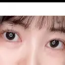 目頭切開 ネビュラクリニック 京都院 DAY 149 サムネイル用