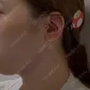 糸リフト / 脂肪吸引（顔） / ジョールファット除去 RIVER CLINIC（リバークリニック） DAY 0 サムネイル用