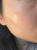 ルメッカ 大美会クリニック 岡山院 AFTER サムネイル用