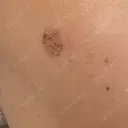ルメッカ 大美会クリニック 岡山院 DAY 2 サムネイル用