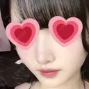 鼻尖形成（切開） / 小鼻縮小（切開） / 軟骨移植 / 鼻柱下降・鼻唇角形成（猫手術） / ボトックス（エラ・小顔） ASTRA BEAUTY CLINIC DAY 23 サムネイル用