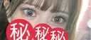 ヒアルロン酸注入（唇） / ヒアルロン酸注入（鼻翼基部） / その他（鼻） / その他（口元） 銀座美容外科クリニック 銀座院 AFTER サムネイル用