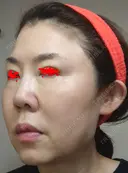 白玉点滴・注射 城本クリニック 大阪院 DAY -2 サムネイル用