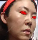 白玉点滴・注射 城本クリニック 大阪院 DAY 1 サムネイル用