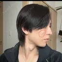 クマ治療 / その他（輪郭） WOM CLINIC GINZA （ワム クリニック ギンザ） DAY 10 サムネイル用