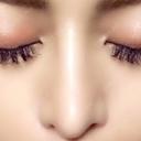 隆鼻術 / 鼻尖形成（切開） / 鼻中隔延長（切開） / 軟骨移植 / プロテーゼ除去 / 鼻修正 湘南美容クリニック 新宿本院 DAY 62 サムネイル用