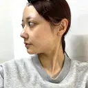糸リフト / バッカルファット除去 / 脂肪吸引（顔） / メーラーファット除去 / ジョールファット除去 / 脂肪吸引注射（顔） / ヒアルロン酸注入（あご） / ボトックス（エラ・小顔） SEA CLINIC（シークリニック） DAY 166 サムネイル用